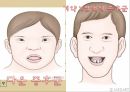 정신지체,정신지체원인,정신지체특성,정신지체치료교육,정신지체현황 17페이지