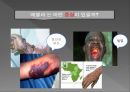 에볼라 바이러스,에볼라 바이러스의 증상,에볼라 바이러스 피해,에볼라 바이러스 예방 8페이지