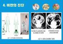 비만의 진단과 합병증 16페이지