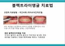 노인 구강관리,구강의 중요성,구강의 실태,구강질환의 위험요인,구강질환 예방법,치아관리법,실버산업의 관점 27페이지