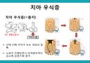 노인 구강관리,구강의 중요성,구강의 실태,구강질환의 위험요인,구강질환 예방법,치아관리법,실버산업의 관점 28페이지