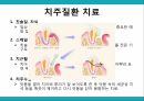 노인 구강관리,구강의 중요성,구강의 실태,구강질환의 위험요인,구강질환 예방법,치아관리법,실버산업의 관점 32페이지