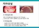 노인 구강관리,구강의 중요성,구강의 실태,구강질환의 위험요인,구강질환 예방법,치아관리법,실버산업의 관점 33페이지