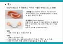 노인 구강관리,구강의 중요성,구강의 실태,구강질환의 위험요인,구강질환 예방법,치아관리법,실버산업의 관점 38페이지