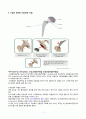 성인간호 대퇴골 골절, 천식 케이스 4페이지