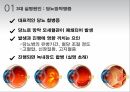 안과 직무교육) 고연령 안과질환 11페이지