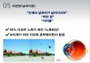 안과 직무교육) 고연령 안과질환 27페이지