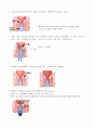 Hemorrhoidectomy-PPH수술 4페이지