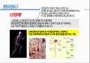 통증생리,통즈으이정의,글곡격계,신경계,말초신경계,감각수용기 20페이지