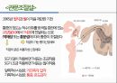 통증의지각과전달과정,통증의신경전달,통증신경회로,연관통증,근막통증후근,척수의신경로,오름조절,통증인지,전기치료 47페이지
