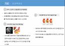담석증 case study 발표자료 8페이지