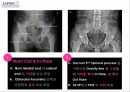 요추-골반의 방사선(x-ray) 분석법 9페이지