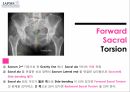 요추-골반의 방사선(x-ray) 분석법 10페이지