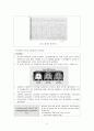 전두엽 증후군 11페이지