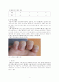 정신건강론 개별개입 레포트, 문제사정, 개입계획, 개입기록지, 자가척도 등 포함 4페이지