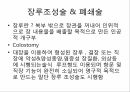 대장암의 진단 & 수술적 치료종류 13페이지
