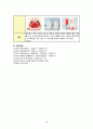 성인간호학 실습, case study, myocadial infaction, 심근경색, 케이스 스터디, 간호진단 5개, 간호중재, 이론적 근거 교수님께서 극찬해주신 자료입니다 21페이지