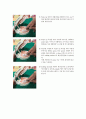 [치위생 A+] 치면세마 기구별 적용과정 (explore, sickle, probe, curet) 10페이지