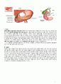 A+ (CASE STUDY 총담관 결석증 및 담관염)- 간호진단 3개 간호과정 3개와 문헌고찰등 아주 자세합니다! 4페이지
