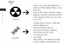 [발표 PPT/4.5(A+) 자료] 백내장(cataract) 17페이지