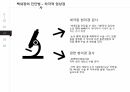 [발표 PPT/4.5(A+) 자료] 백내장(cataract) 22페이지
