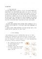 [레포트/4.5(A+) 자료] 백내장(cataract) 16페이지