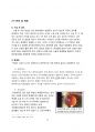 [레포트/4.5(A+) 자료] 백내장(cataract) 18페이지