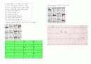 성인간호학 - 과제 심근경색(myocardiac infarction) 3페이지