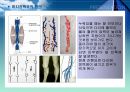 정맥류 3페이지