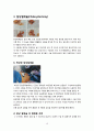 a++++ 칭찬받은 과제 성인간호학 수술실 or 케이스 실습 laparoscopic cholecystectomy 복강경 담낭 절제술 진단5개 과정2개 10페이지
