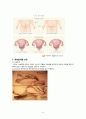 a+++ 꼼꼼한 케이스 간호학과 실습 여성간호 모성간호 분만실 케이스 유도 분만 (induction of labor) 간호진단 1 수술부위와 관련된 통증 , 2 급성통증과 관련된 활동지속성 장애, 3 불안과 관련된 지식부족민주 6페이지