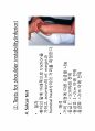 물리치료 스페셜테스트 special test  진단및 평가 정리자료 14페이지