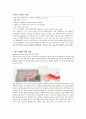 아동간호학실습-선천성 게실증 [간호진단 및 간호과정 3개] 2페이지