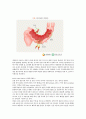 아동간호학실습-선천성 게실증 [간호진단 및 간호과정 3개] 3페이지