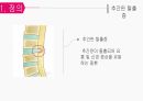 성인간호학 신경계/척수 손상 장애 대상자 간호 [PPT 발표자료] 16페이지