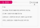 성인간호학 신경계/척수 손상 장애 대상자 간호 [PPT 발표자료] 18페이지