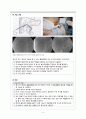 성인간호학 간암 주제학습 (PTBD관리, Liver diet, HCC치료) 4페이지