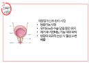 산욕기 산모의 신체적변화 및 간호사정 [PPT 발표자료] 16페이지