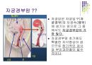 여성간호학 자궁경부암 [PPT 발표자료] 4페이지