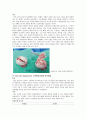 성인간호학실습 케이스스터디 (대퇴골두 무혈성 괴사) [간호진단 및 간호과정 4개] 5페이지