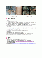위암(gastric cancer) 질병고찰(질병연구, 문헌고찰) 4페이지