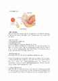 여성간호실습 자궁근종(uterine myoma), 자궁경부암(cervical cancer) 질병고찰(질병연구, 질병보고서, 문헌고찰) A+ 17페이지