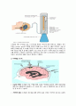 성인간호실습 중환자실(ICU) 두개내압 상승(IICP) 정의 및 관리 과제 A+  5페이지
