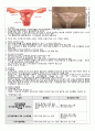 성인간호실습 수술실 case study(케이스스터디) Hysterectomy(자궁절제술) LAVH 수술과정기술 포함 A+ 6페이지
