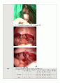 성인간호실습 수술실 case study(케이스스터디) Hysterectomy(자궁절제술) LAVH 수술과정기술 포함 A+ 21페이지