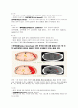 신규간호사도 이해할 수 있게 만든 뇌내출혈 및 두개내압 공부 9페이지