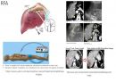 Cardiac conference! 11페이지