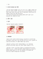 [성인 A+] 전립선암(prostatic carcinoma, prostate cancer) case study 간호진단 3개 2페이지