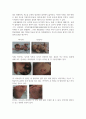 미숙아 케이스, 간호과정, 간호진단, 자세함, A+ 5페이지