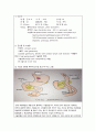 수술실 보고서. stomach cancer , total gastrectomy, 성인간호실습 1페이지